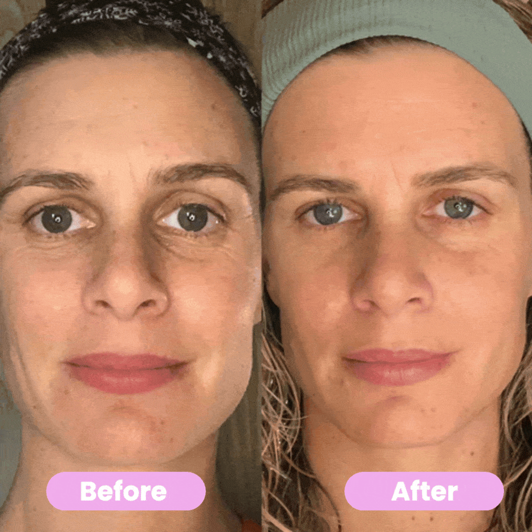 Musevia LumiLift 7 LED Facial & Neck Massager – Relax, Refresh & Glow Every Day